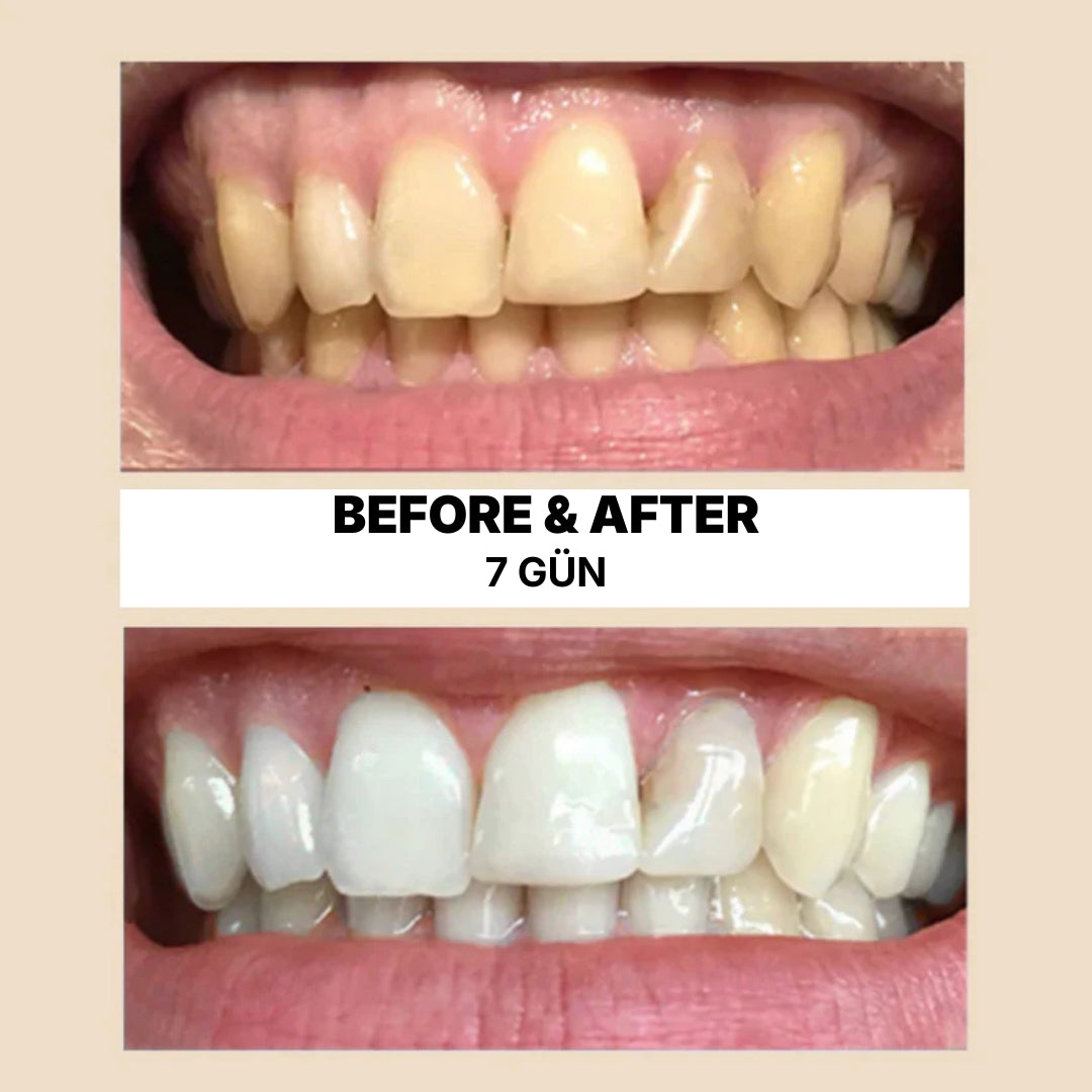 Doğal Diş Beyazlatma & Ağız Bakım Stick